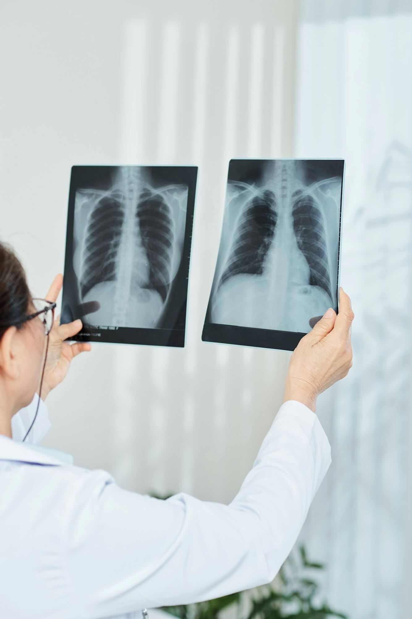 Doctor comparing chest x-rays